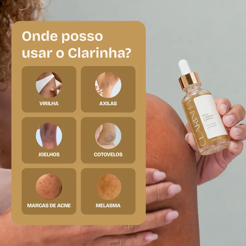 Áreas indicadas para aplicação do Sérum Corporal Clarinha